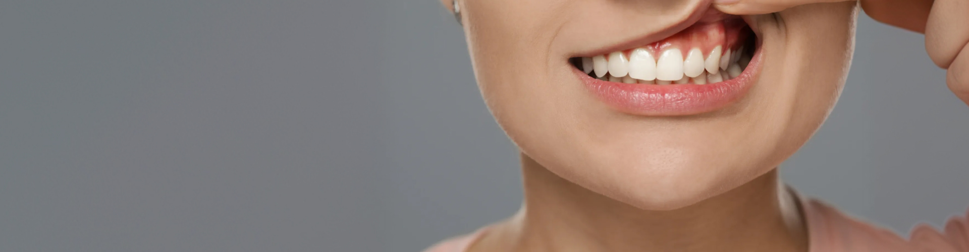 Woman lifting upper lip to show gums.
